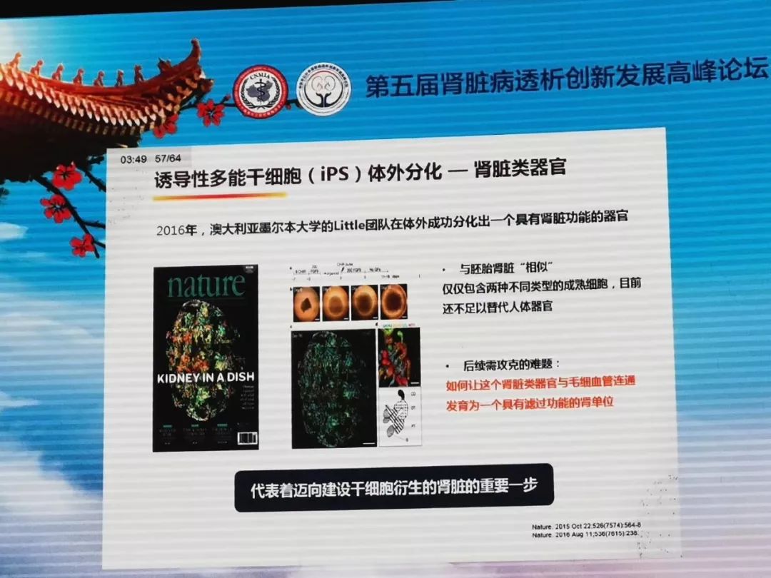 三维人工肾最新进展与研究动态
